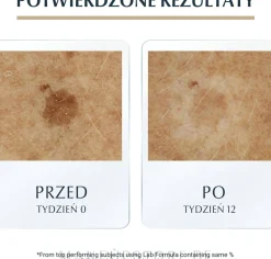 Anti-Aging Gesichtsserum mit Hyaluronsäure gegen Altersflecken für mehr Hautelastizität für reife Haut