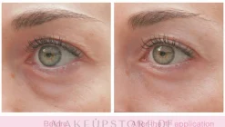 Aufhellende und feuchtigkeitsspendende Anti-Aging Augencreme