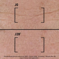 Intensives korrigierendes Serum für alle Arten von Falten