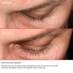 Serum zur Stärkung der Wimpern