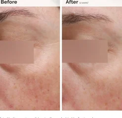 The Ordinary Niacinamide 5% Face & Body Emulsion